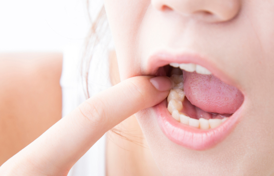 口腔内チェック（歯ぐき・噛み合わせ）