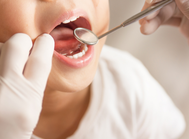 02 予防を重視したお口のサポート